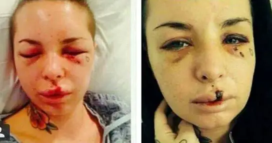 Former performer Christy Mack was severely beaten by her MMA boyfriend in 2017